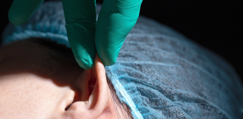 Professional earlobe repair surgery treatment for torn, stretched or damaged earlobes restoring natural shape and appearance.