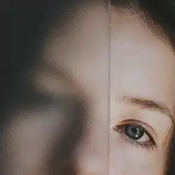 Botox injections to treat blurred vision caused by eye muscle imbalance in Ondipudur