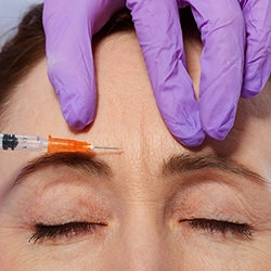 Botox helps prevent chronic migraines by blocking pain signals, offering lasting headache relief and comfort
