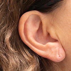 Safe and effective uneven earlobe correction near Ukkadam, Coimbatore to restore facial balance and confidence.