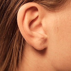 Earlobe reshaping procedure near Ukkadam, Coimbatore to fix large or sagging earlobes for a youthful, balanced look.