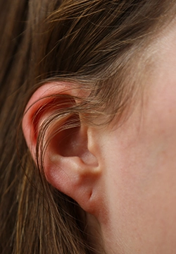 Safe and personalized earlobe symmetry correction near Town Hall, Coimbatore for a balanced ear shape.