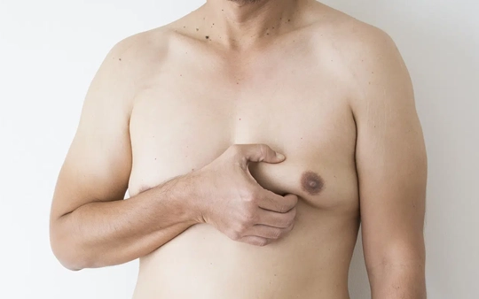 Male Gynecomastia Breast Reduction Plastic Surgery in Gandhipuram A plastic surgeon performs male gynecomastia breast reduction surgery in Gandhipuram for chest contouring.