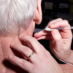 Botox therapy for cervical dystonia and neck cramps with expert care and lasting relief