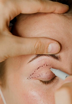 Treat frequent eye twitching and eyelid spasms with Botox therapy for blepharospasm near Town Hall.