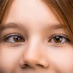 Botox in Peelamedu to treat crossed eyes by relaxing muscles for better eye balance and vision