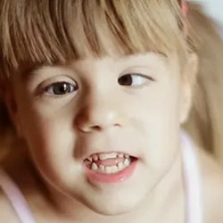 Child with strabismus or lazy eye receiving botulinum treatment to improve visual alignment