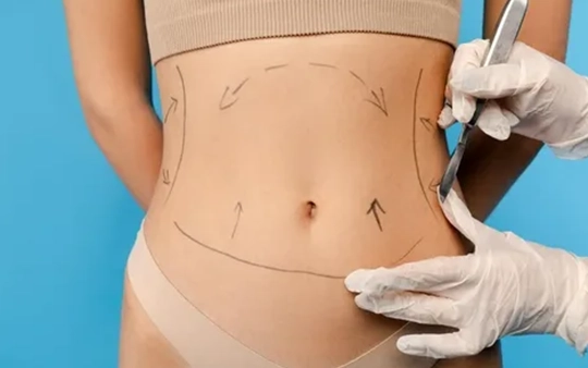 Liposuction and fat reduction surgery near Vadavalli, Coimbatore for a slimmer and contoured body
