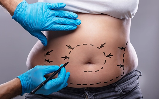 Flatten and tone your abdomen with safe tummy tuck surgery for a firmer, confident look.