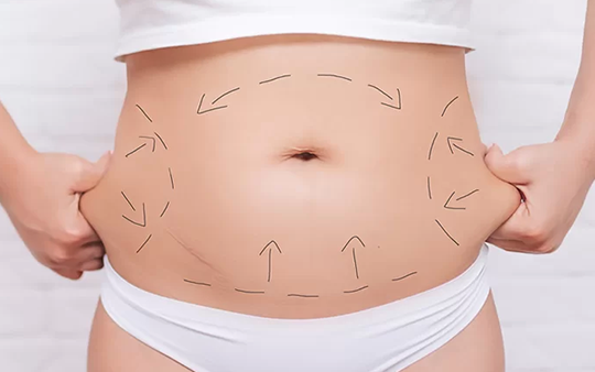 Best Tummy Tuck & Abdominoplasty Surgery Near Town Hall Top abdominoplasty surgeons for advanced tummy tuck surgery Near Town Hall, Coimbatore