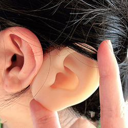 Correct uneven earlobes with safe ear correction surgery Near Avinashi Road for natural symmetry.
