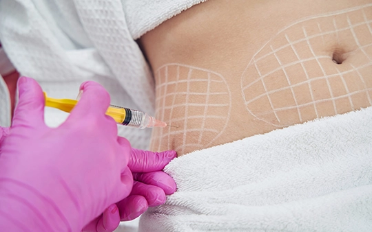 Remove stubborn fat with advanced liposuction for smooth contours and confident body shape.