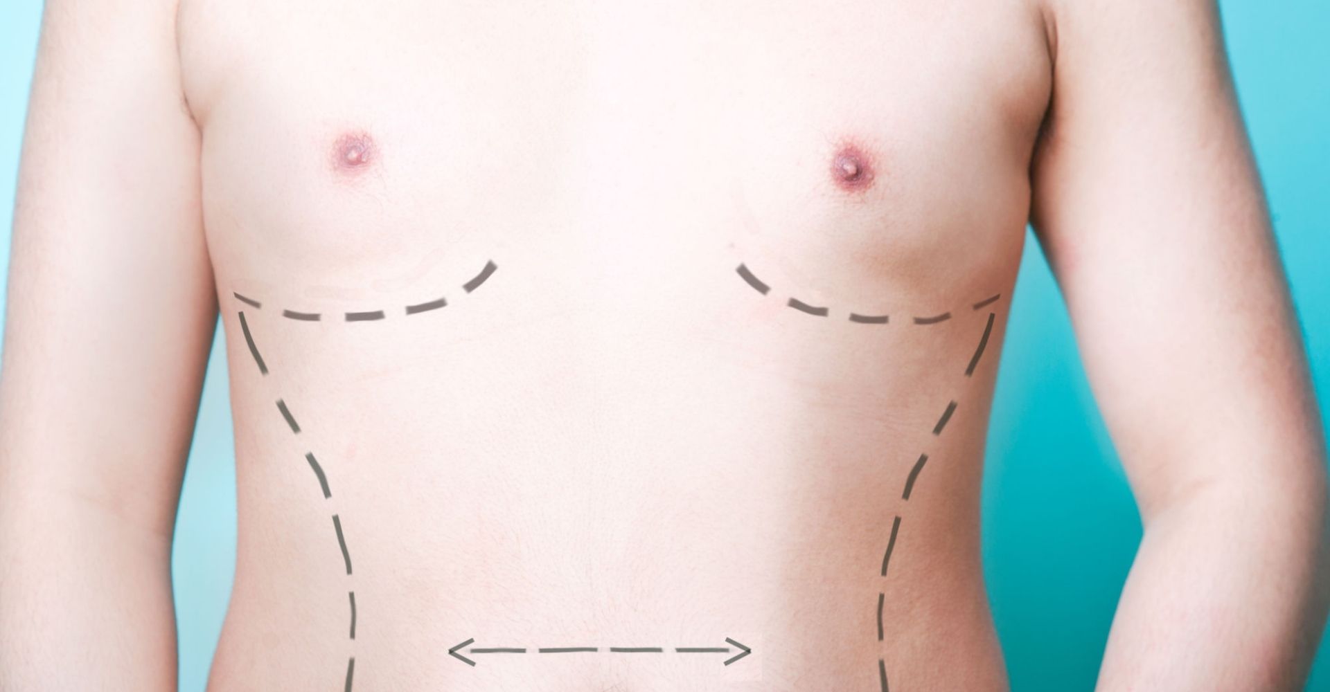 Best Cosmetic Surgery Tummy Tuck Treatment in Coimbatore
